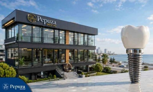 Atakum’da Diş İmplantları