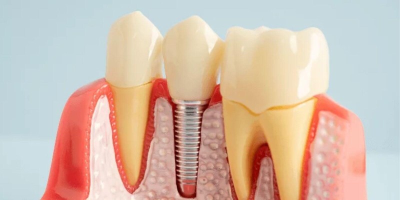 samsun atakum dişçi