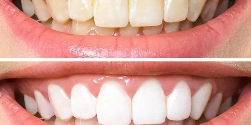 samsun atakum dişçi