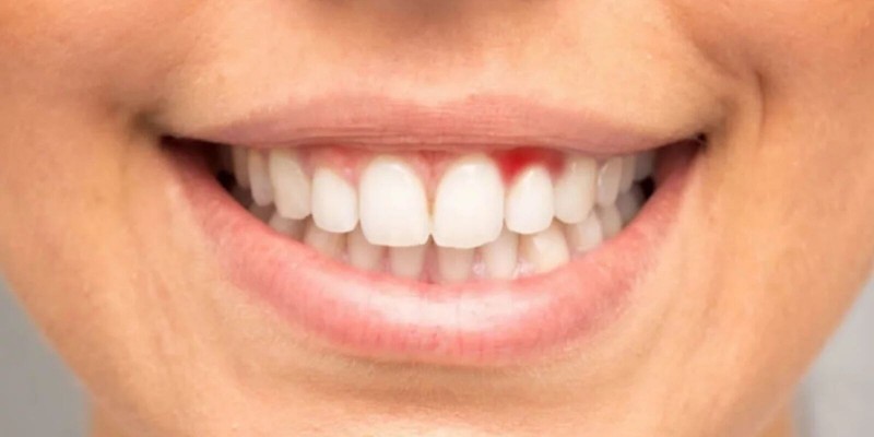 samsun atakum dişçi