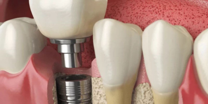 samsun atakum dişçi