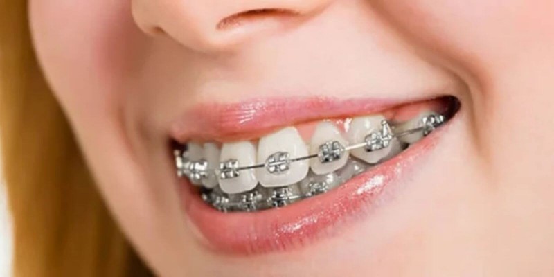 samsun atakum dişçi