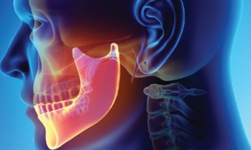 Çene Eklem Hastalıkları İçin Hangi Tedavi Yöntemleri Mevcuttur?