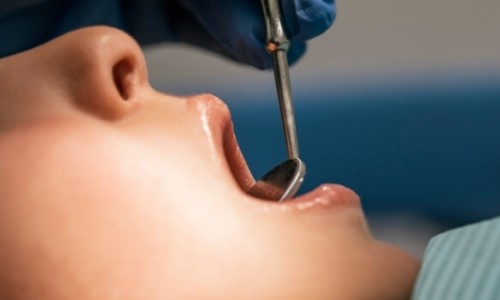 Çene Kisteleri Nedir ve Tedavisi Nasıl Yapılır? Çene Kisteleri Nedir ve Tedavisi Nasıl Yapılır?