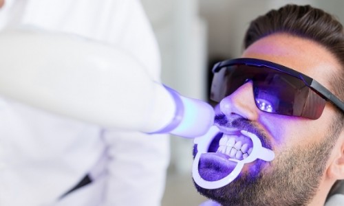 Diş Beyazlatma Zararlı mı? Etkisi Ne Kadar Sürer?