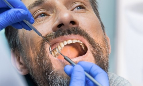 Samsun-Atakum Diş Apsesi Neden Tehlikelidir ve Nasıl Tedavi Edilir?