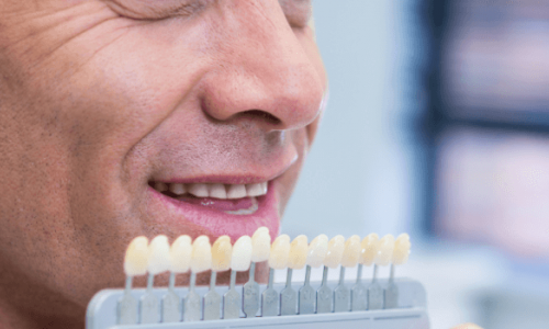 Samsun - Atakum Zirkonyum Diş Kaplama mı Porselen mi? Hangisi Daha İyi?