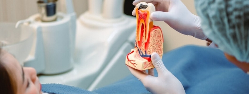 Kök Kanal Tedavisi Sonrası Dikkat Edilmesi Gerekenler Nelerdir?