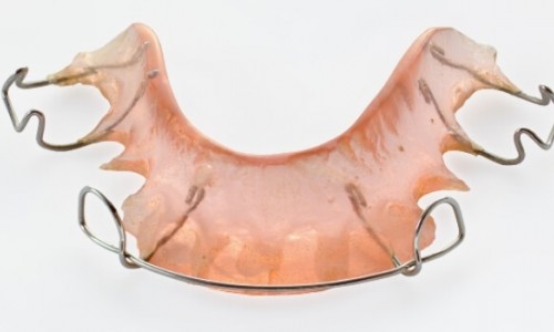 Takıp Çıkartmalı Apareyler (Damaklık) Nasıl Kullanılır?