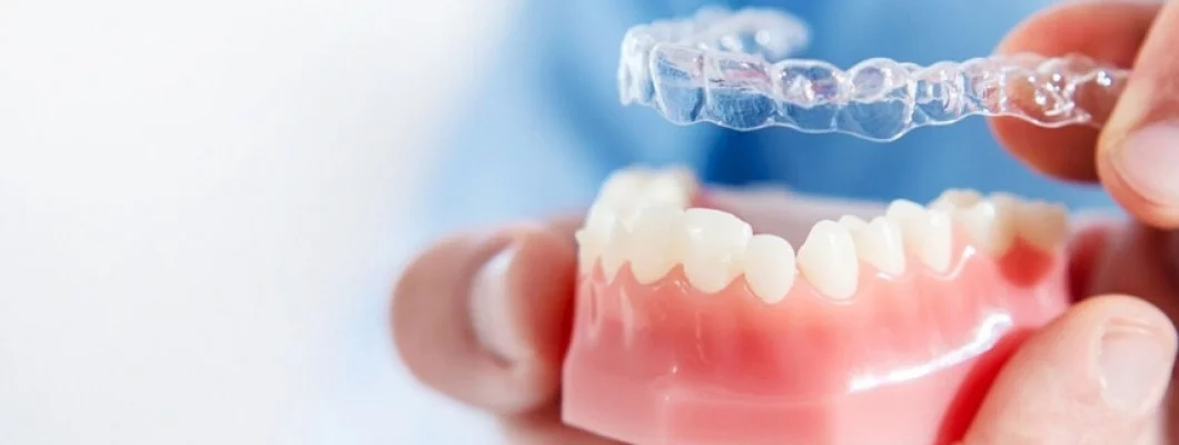 Telsiz Ortodontik Tedavi (Invisalign) ile Geleneksel Teller Arasındaki Farklar Nelerdir? Telsiz Ortodontik Tedavi (Invisalign) ile Geleneksel Teller Arasındaki Farklar Nelerdir?