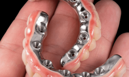 Diş Protezi Uyumu İçin Ne Zaman Doktora Başvurulmalı?